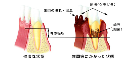 にしかわ歯科・診察室